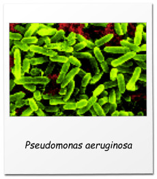 Pseudomonas aeruginosa